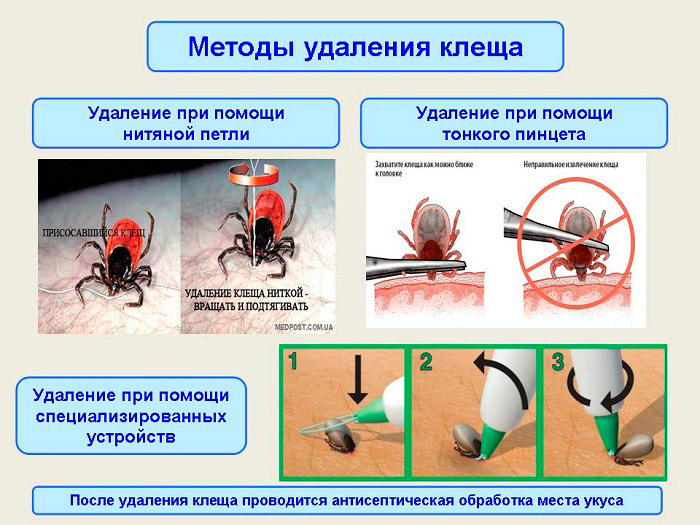 Укусил клещ. Что делать